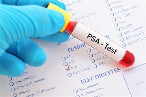 alcohol and psa test